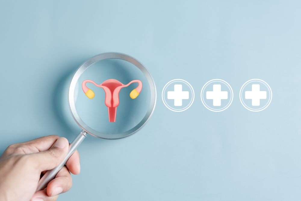PCOS Treatment in New Port Richey What a Combined Hormone + Weight Loss Program Actually Looks Like