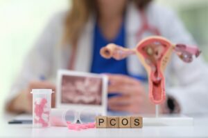 pcos treatment in new port richey florida