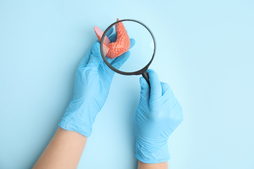 pcos and thyroid